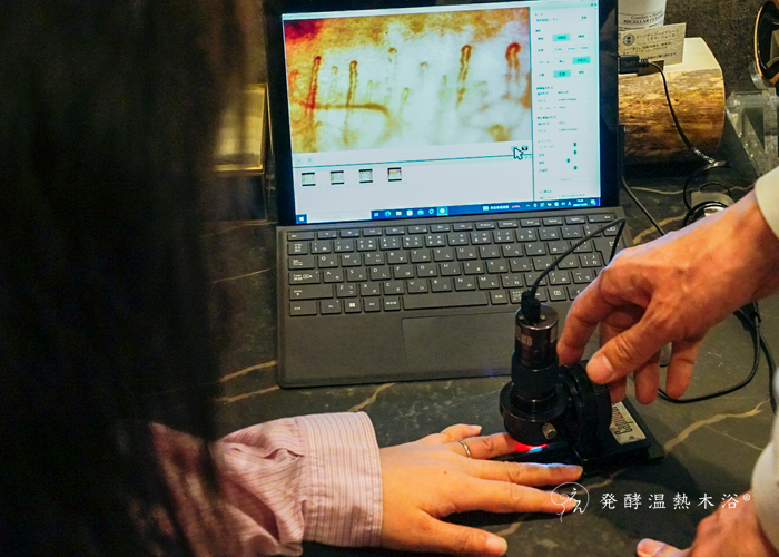 血流速度の測定